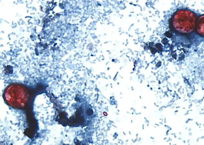 This Summer Was Shitty Enough But Now We Have Cyclospora