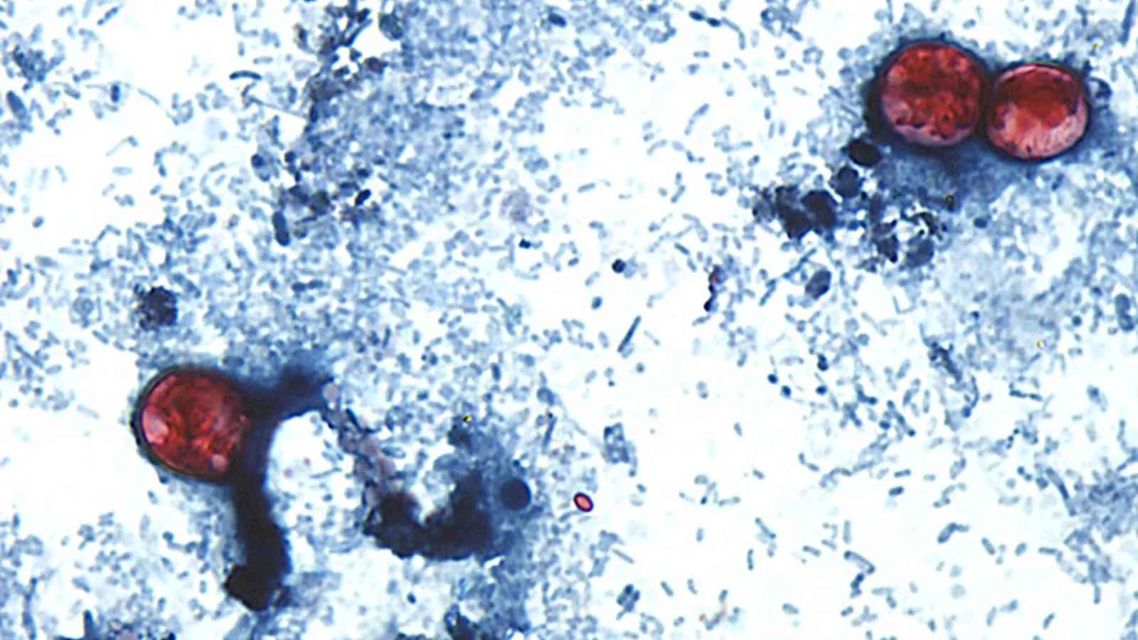 This Summer Was Shitty Enough But Now We Have Cyclospora